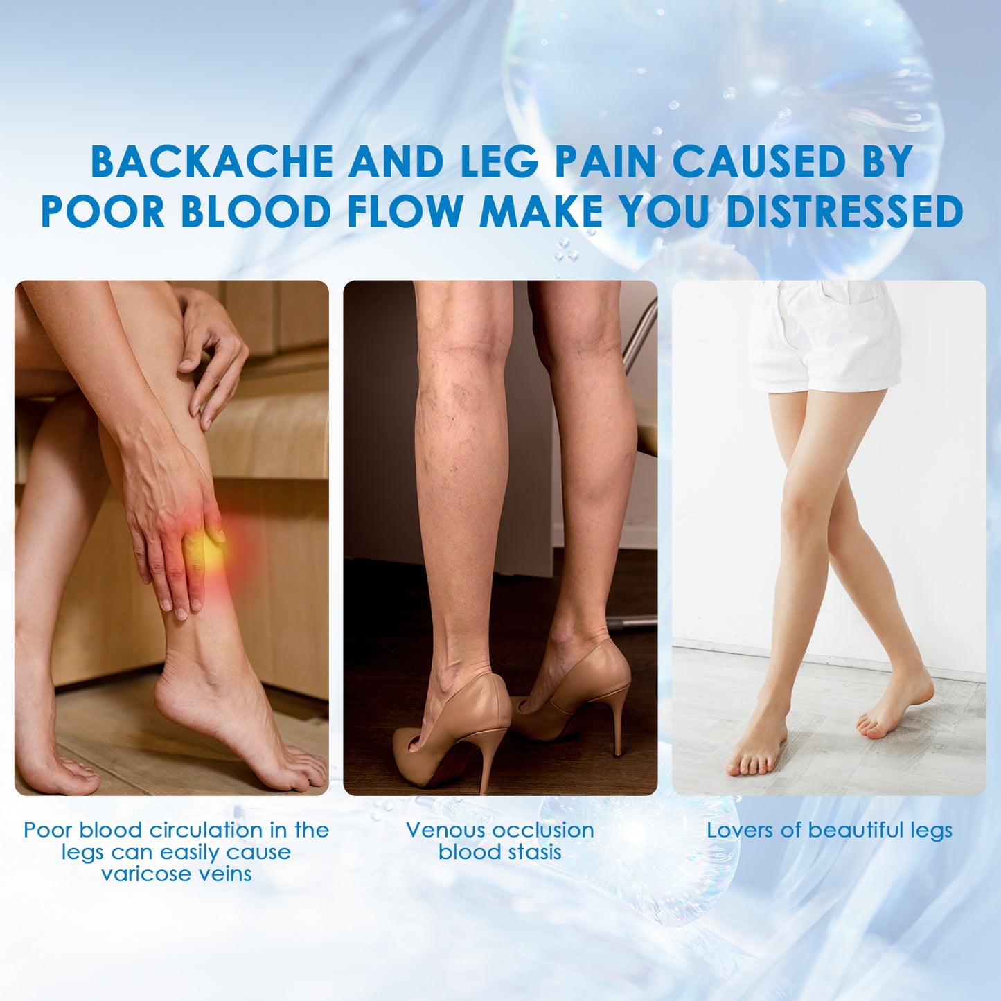 Varicose Vein Relief Spray