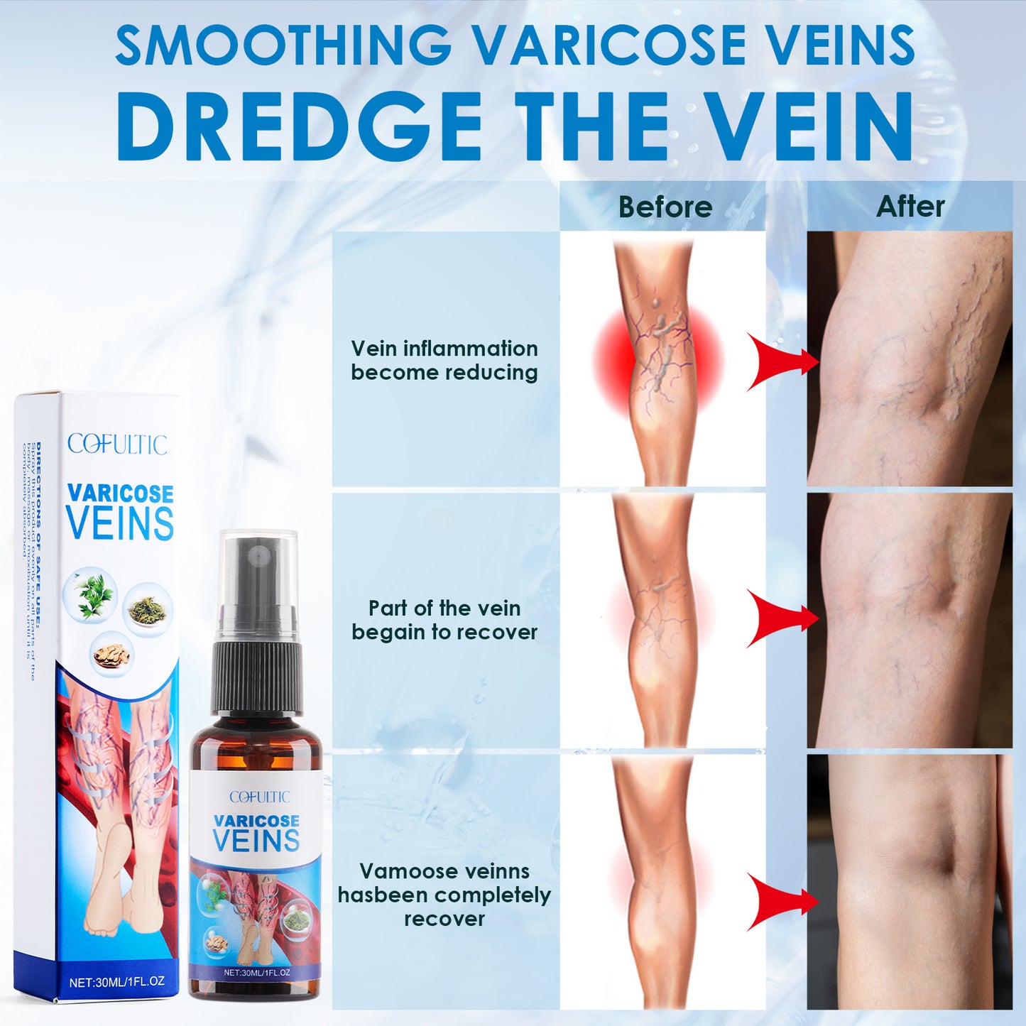 Varicose Vein Relief Spray