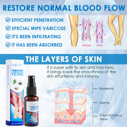 Varicose Vein Relief Spray
